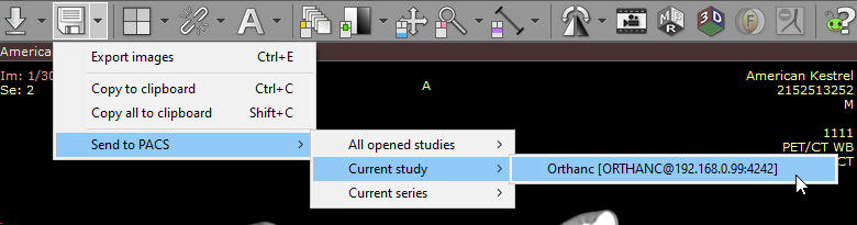 从查看器发送到 PACS