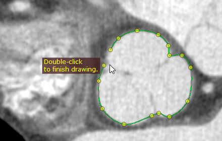 绘制封闭多边形
