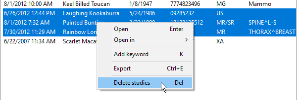删除检查右键菜单