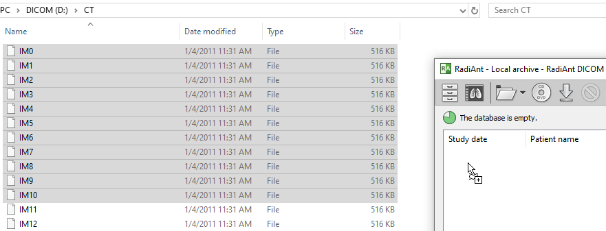 拖放导入 DICOM 文件