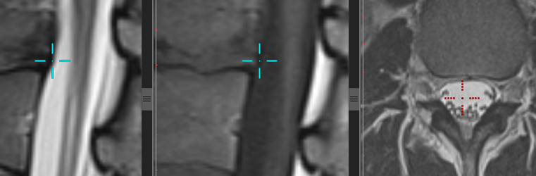 3D 光标不在图像平面上