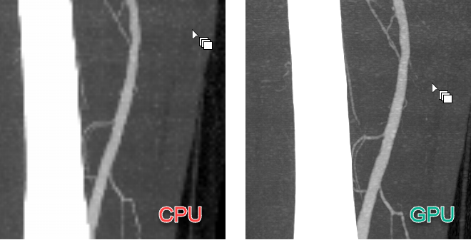 3D MPR：GPU 与 CPU 性能对比