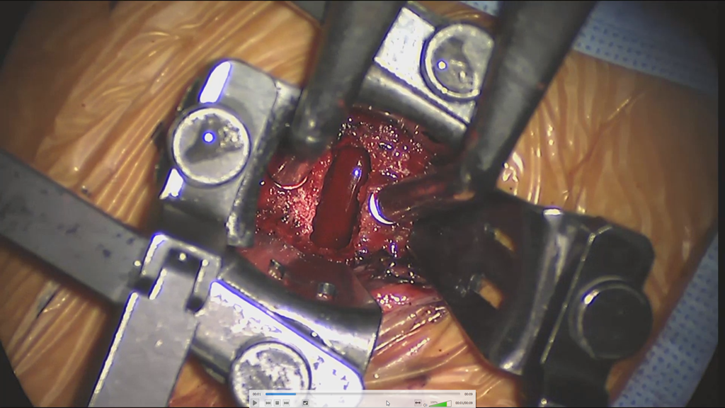 外部媒体播放器