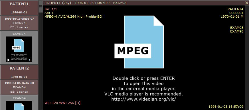 MPEG 视频显示界面