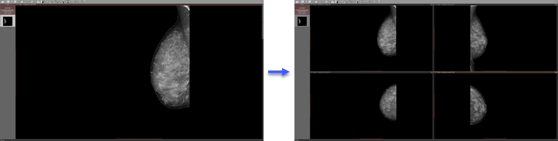 非容积图像拆分序列