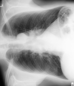 逆时针旋转 90°