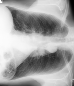 顺时针旋转 90°